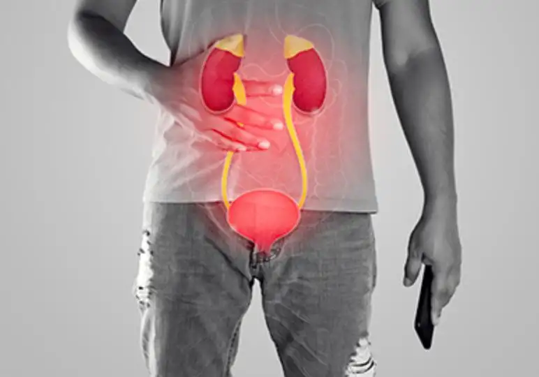 Causes of Bladder Cancer Symptoms: A Complete Guide to Risks, Signs, and Prevention