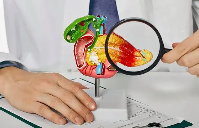 Final Stages of Pancreatic Cancer: Symptoms, Treatment Options, Prognosis, and Support Guide