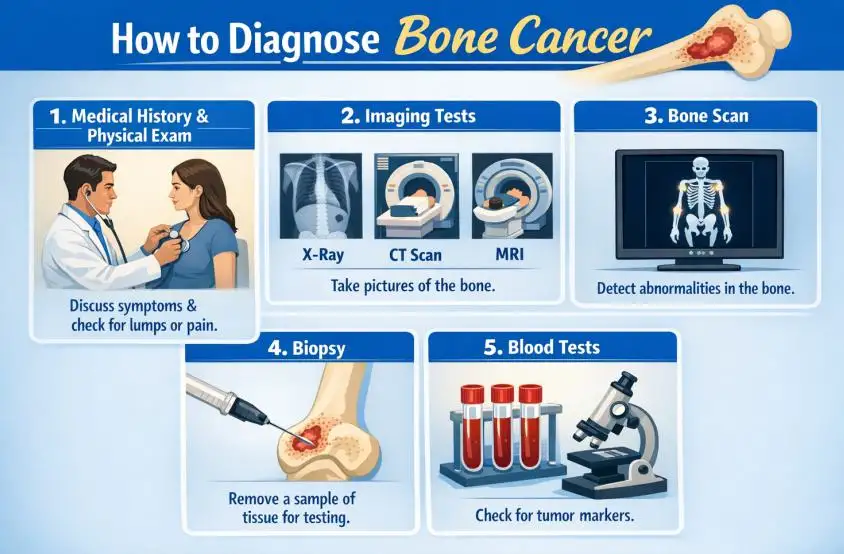 How to Diagnose Bone Cancer: Complete Guide to Early Detection, Tests, and Treatment Decisions