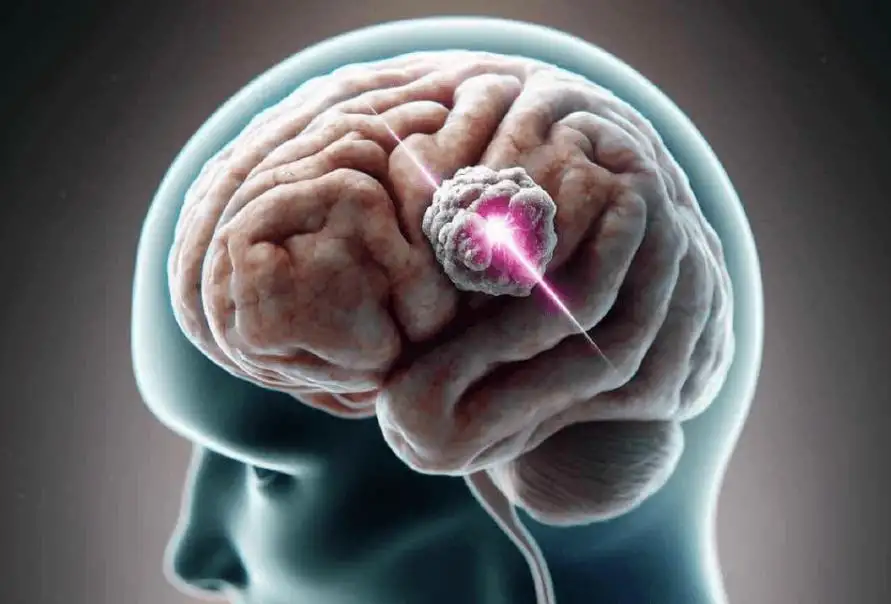 Caring for Yourself During Brain Tumor Treatment: A Guide to Supportive Care