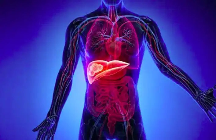 Secondary Liver Cancer Life Expectancy: Prognosis, Survival Rates, and Treatment